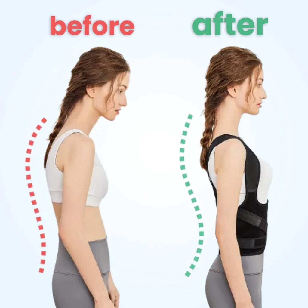 FitForm™ Back Posture Corrector